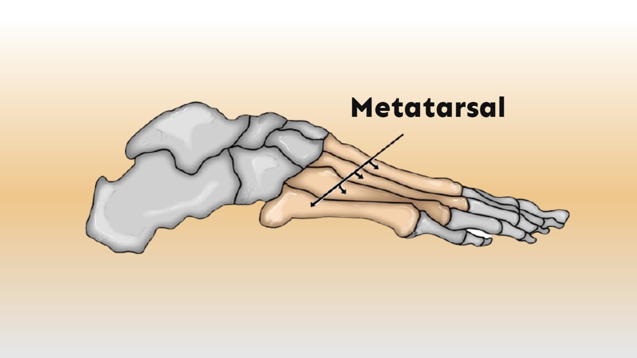 best running shoes for metatarsal pain