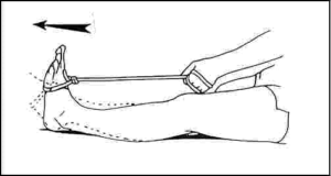 Theraband Exercises