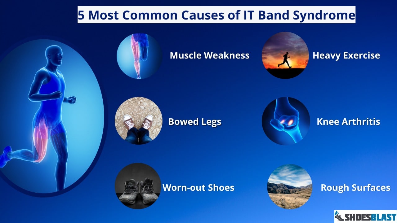 common causes of itbs